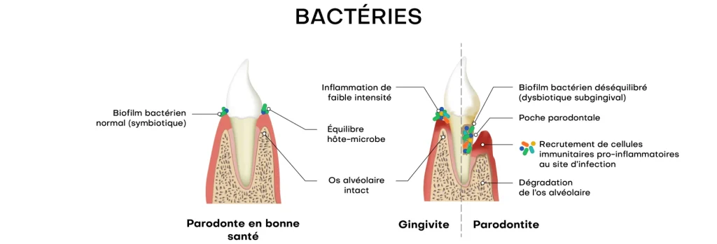 Prévention, dépistage des maladies parodontales