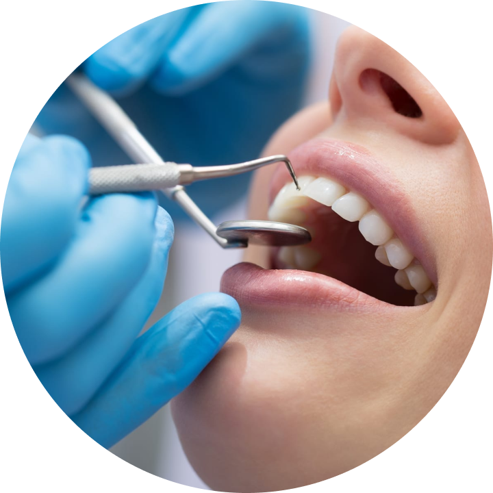 Les prothèses fixes